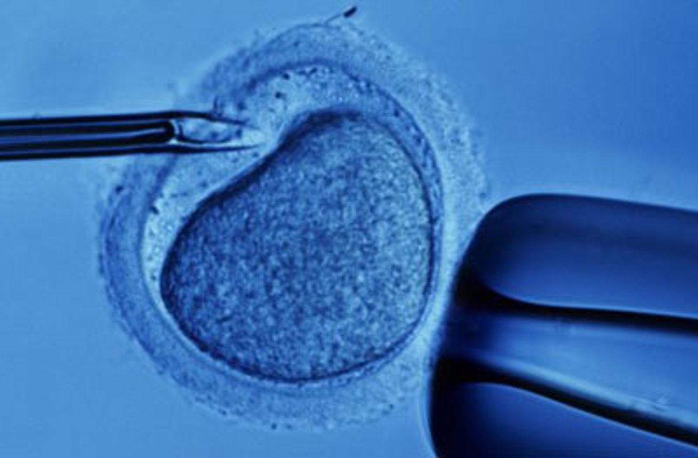 <p>(sztuczna macica) - A device that allows a fetus to develop outside a human body.</p>