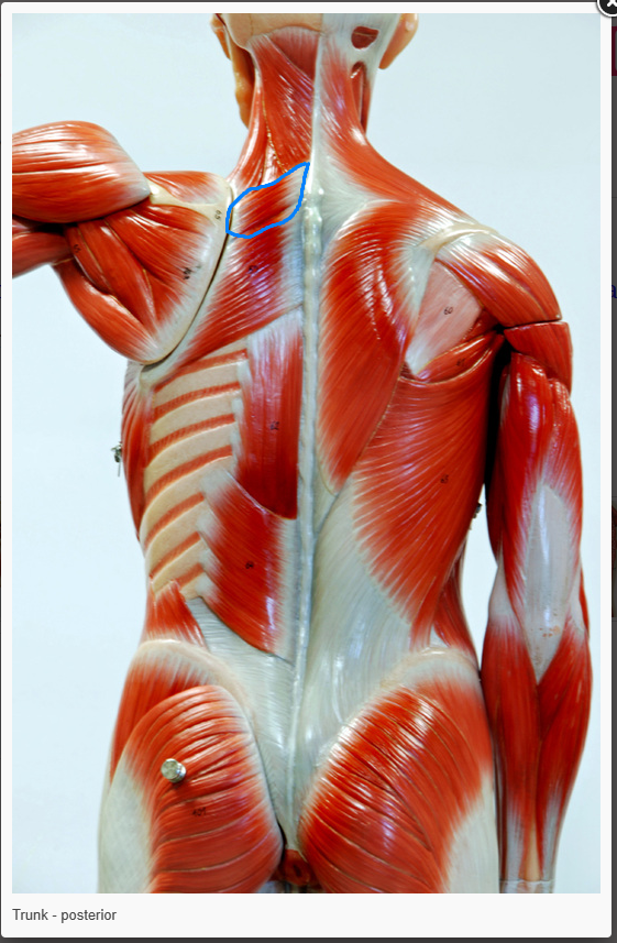 <p>what is the name of the muscle circled </p>
