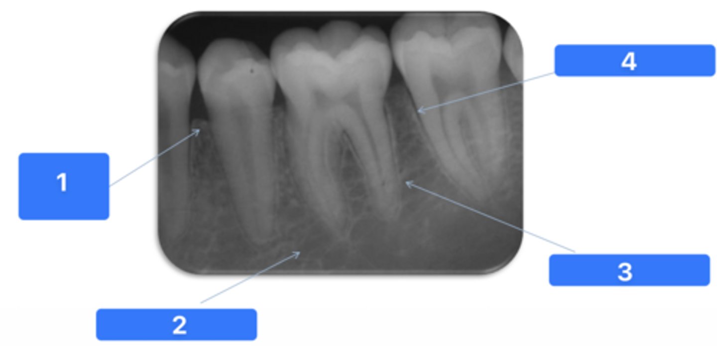 <p>ID the structure at #1:</p>