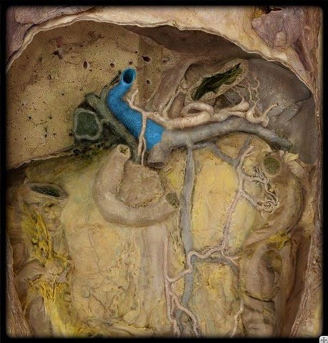 <p>Name this vessel.</p>