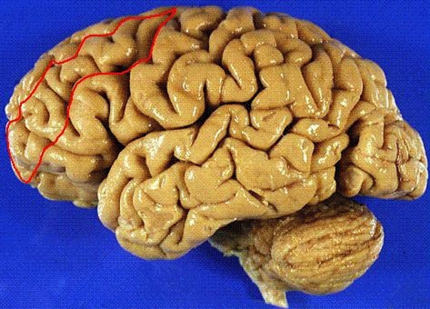 <p>the frontal lobe gyrus that is located between the superior and inferior frontal gyri</p>