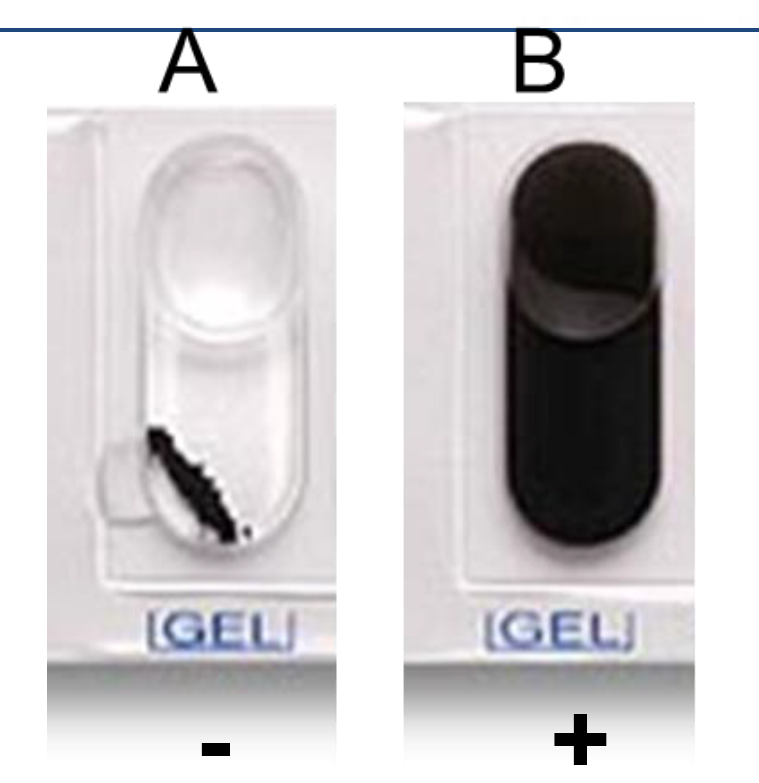 <p>Gelatinase (GEL) Test</p><p>Determine whether bacteria can hydrolyze gelatin (Kohn’s charcoal gelatin) by gelatinase.</p><p></p>