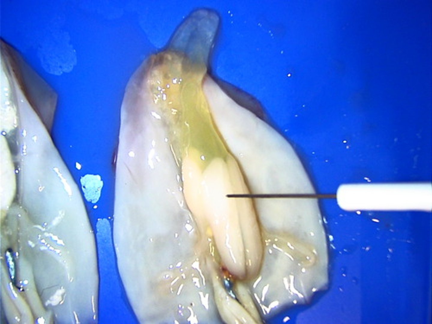 <p>This is a female reproductive organ. It provides a protective coating for the eggs.</p>