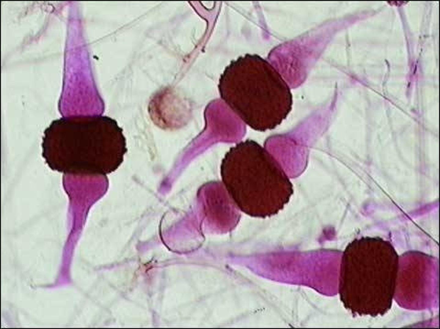 <p>think walled receptacle for zygospores; formed after gametangia forms; produces sporangium</p>