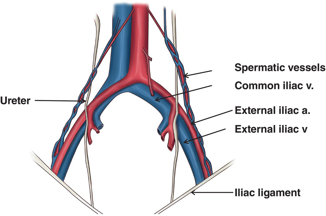 <p>comes from adrenal gland</p><p>drains into renal vein</p>
