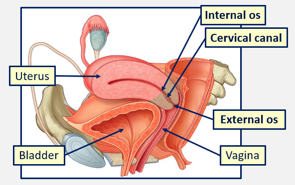 <p>Cervical canal</p>