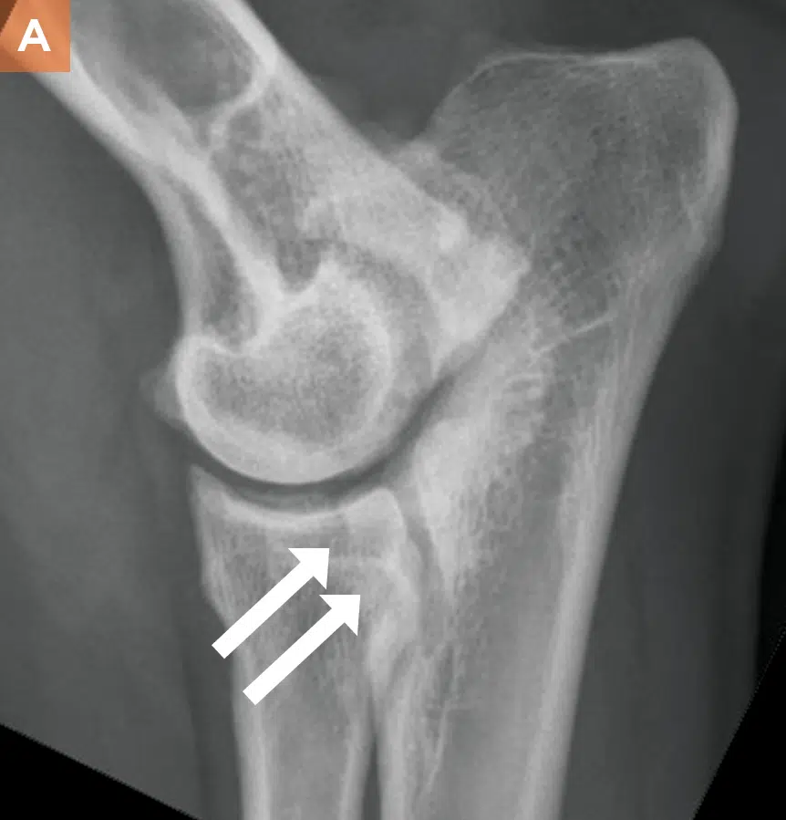 <p>Radiologically: Osteophytes on anconeal process. Surgical exploration may reveal FCP</p>