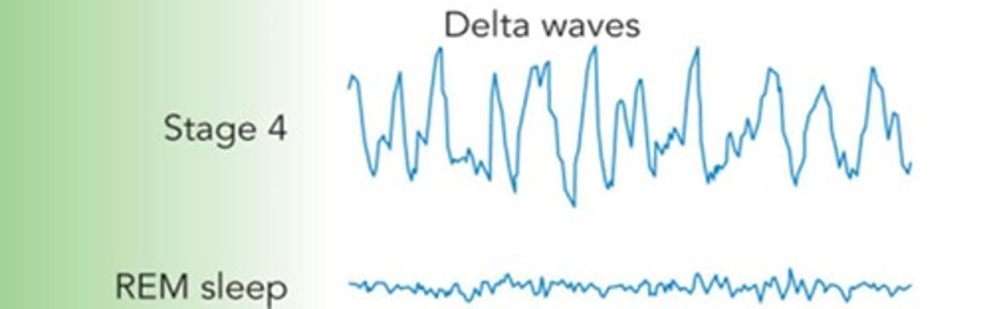 <p>- rapid eye movement</p><p>- high frequency beta waves</p><p>- dreams</p><p>- amount of REM increases as night goes on</p>