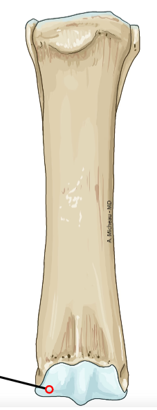 <p>Medial distal condyle; articulates with tibia.</p>