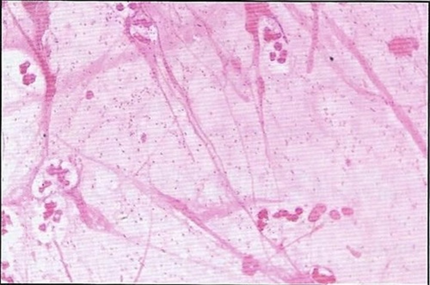<p>How long it takes for a disease to show symptoms. With Cholera it was 24-48 hours, which is why over 700 people died in the first 10 days of the outbreak in 1854.</p>