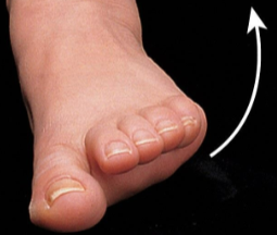 <p><span><span>Movement of the soles of the feet laterally so they face away from each other. </span></span></p>