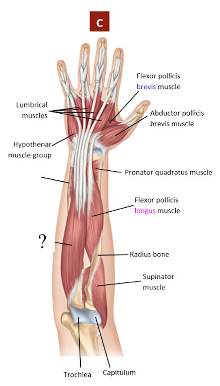 <p>deep and medial, has 4 tendons attached from the 2nd to 5th fingers</p><ul><li><p>flexes the wrists, knuckles, fingers, EXCEPT for the thumb</p></li></ul><p></p>