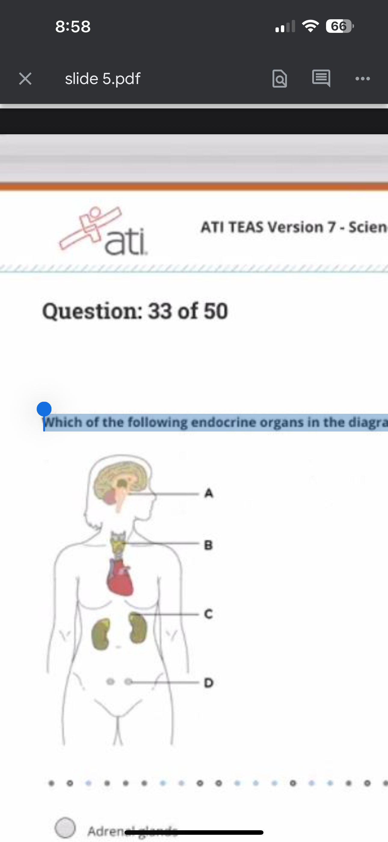 <p>Which of the following endocrine organs in the diagram below is involved in regulating milk production following childbirth?</p>