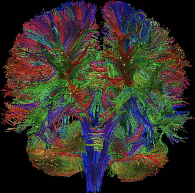 <p>DTI → MRI technique that measures the direction and speed of the diffusion of water molecules in the brain</p><ul><li><p>Alternative to normal MRI (whose magnets are optimized for lipids)</p></li><li><p>Used to identify axon tracts</p></li><li><p>Colours indicate the direction of water molecule diffusion</p></li></ul><p></p>