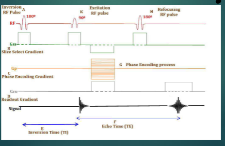 <p><span><span>For the following image, what type of pulse sequence does it<br>represent?</span></span></p>