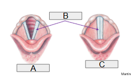 <p>A</p>