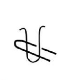 <p>What kind of stitch formation is this?&nbsp;</p>