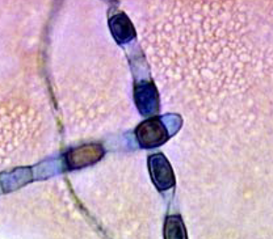 <p>what type of hyphae is this</p>