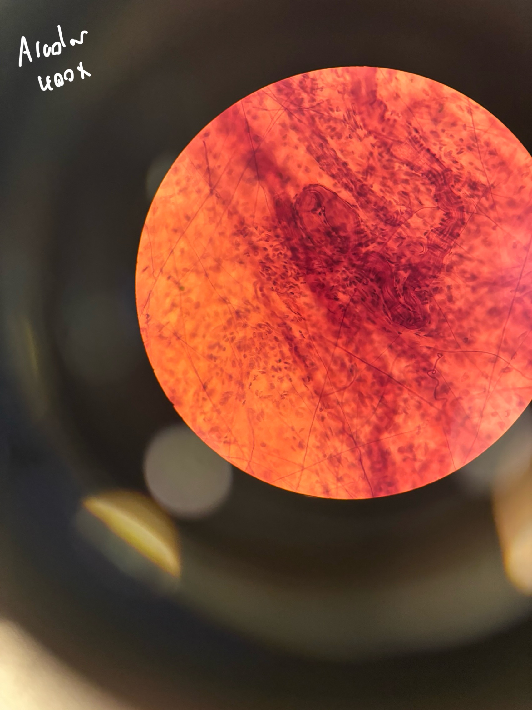 <p>What is the function of reticular tissue?</p>