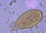 <ul><li><p>known for 100s of years</p><ul><li><p>first trematode life cycle described</p></li></ul></li><li><p>one of the largest trematodes</p><ul><li><p>30 mm long by 13 mm wide</p></li></ul></li><li><p>DH— ruminants, humans</p></li><li><p>IH0— aquatic snail</p></li><li><p>RH— sheep, cattle, rabbits</p></li><li><p>human cases in europe, africa, south america</p><ul><li><p>few cases in US</p></li><li><p>parasite common in areas of south and west</p></li></ul></li></ul><p></p>