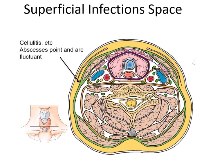 <p>potential space in the neck that lies just under the skin, above the deep cervical fascia</p>