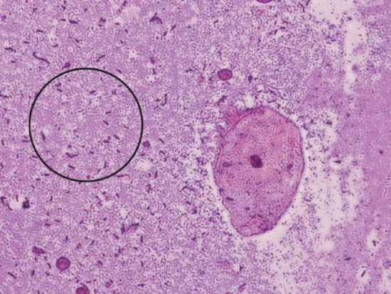 Vaginal Lactobacillus bacteria (circled). (© Richard C. Li.)