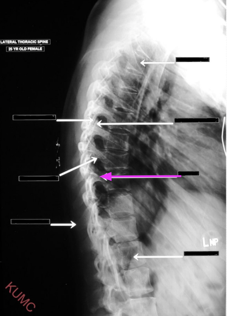 <p>What structure is referenced by the arrow highlighted in pink?</p>