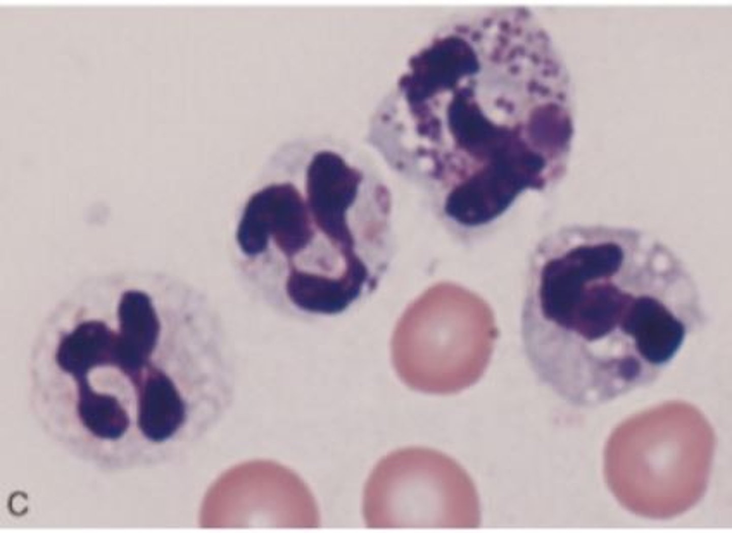 <p>Neutrophils with small dark cytoplasmic granules of Ig</p>