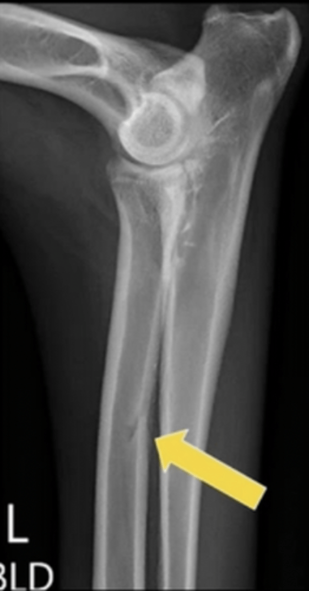 <p>What is the arrow pointing to?</p>