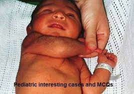 <p>Evaluation of neonate/infant muscle tone where arm is moved across chest to opposite shoulder. </p>