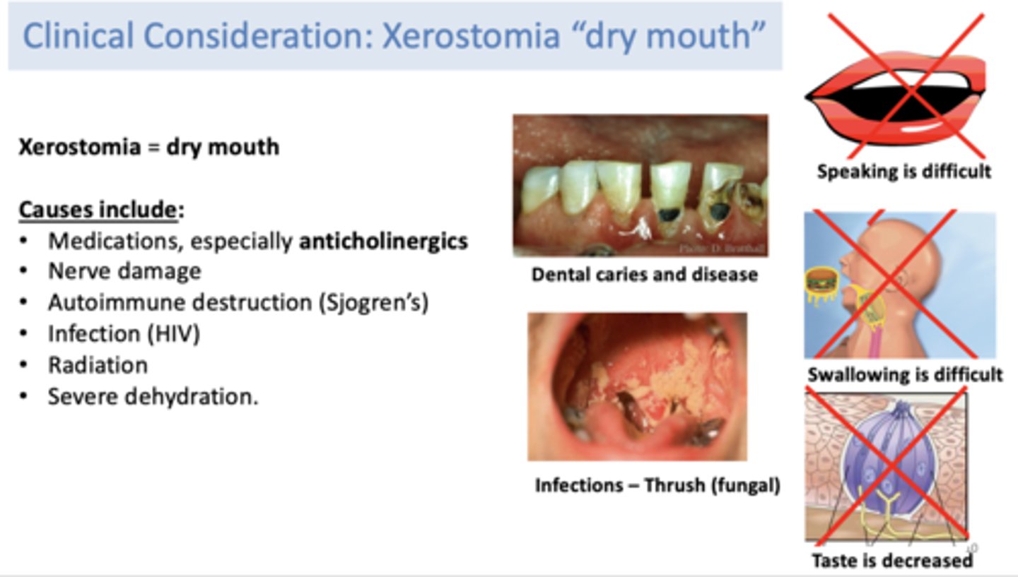 <p>• Medications, especially anticholinergics</p><p>• Nerve damage</p><p>• Autoimmune destruction (Sjogren’s)</p><p>• Infection (HIV)</p><p>• Radiation</p><p>• Severe dehydration.</p>