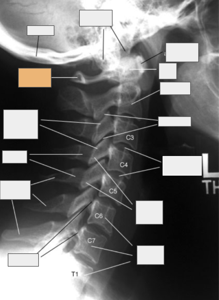 <p>What structure of the spine does the box highlighted in orange reference to?</p>