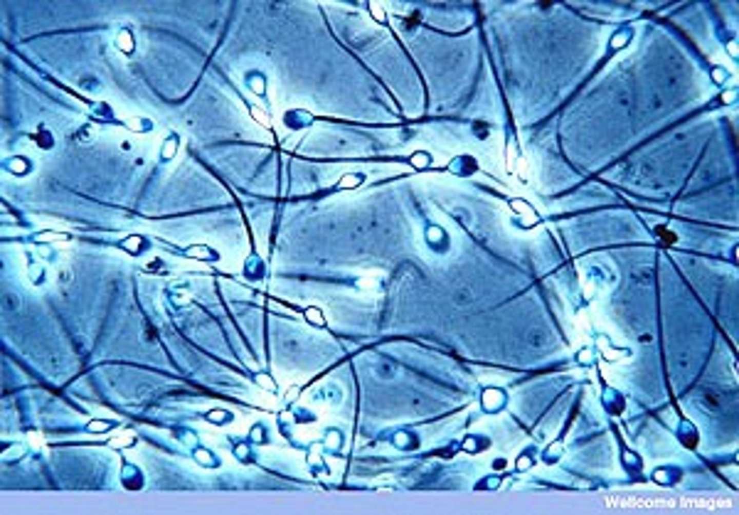 <p>male gametangia</p>