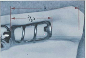 <p>a distal extension base must cover the retromolar pad</p><p>this is to provide appropriate mechanical support, the minor connector should extend be two-thirds the length of the edentulous ridge</p>