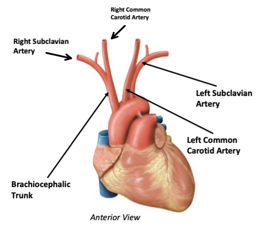 <p>Three major branches off the aorta</p><ul><li><p>﻿﻿Brachiocephalic Trunk</p><ul><li><p>The brachiocephalic trunk bifurcates (ends and splits)</p><p>into the right common carotid artery and the right subclavian artery</p></li></ul></li><li><p>﻿﻿Left Common Carotid Artery</p></li><li><p>﻿﻿Left Subclavian Artery</p></li></ul>