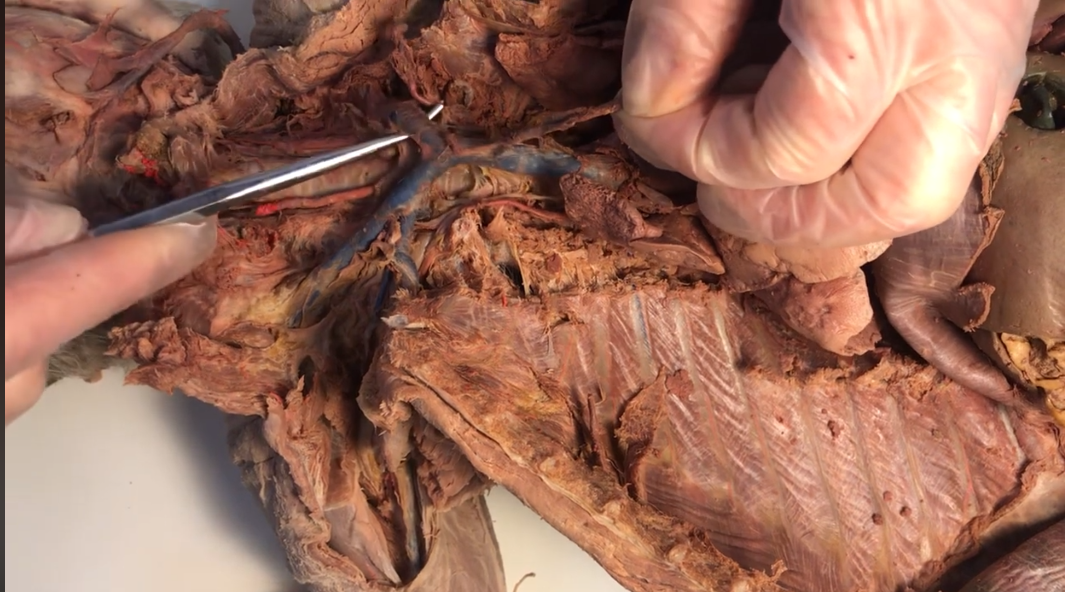 <p>What vein is this</p>