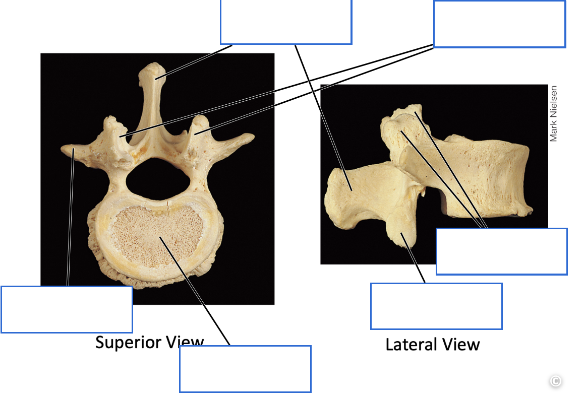 <p>Identify the bone features of the lumbar vertebrae</p>