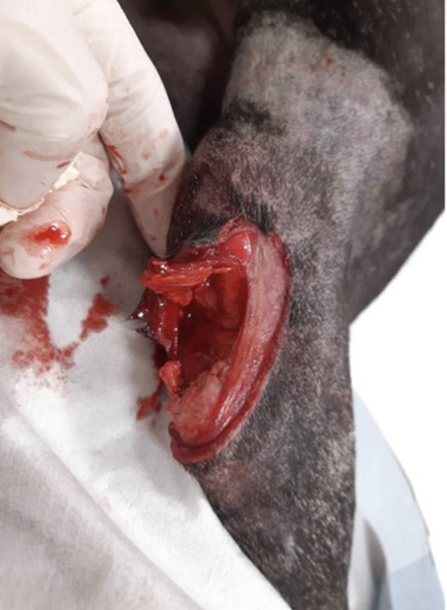 <p>Lacerations</p><p>Causes?</p><p>Can affect any muscle-tendon unit, but where commonly?</p><p>Dx?</p>