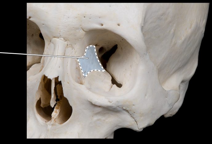 <p>Name this bone.</p>