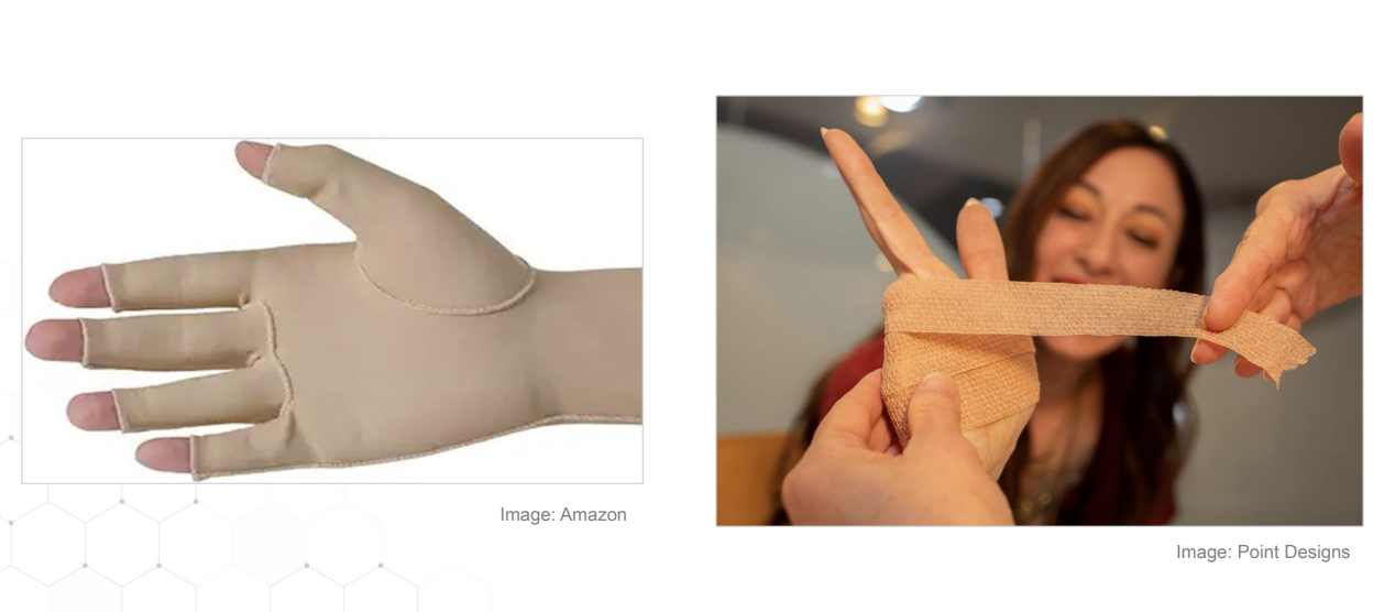 <ul><li><p>compression: apply tension most distally, lessen up on pressure proximally </p><ul><li><p>coban </p></li><li><p>tubigrip </p></li><li><p>ACE wrap </p></li></ul></li><li><p>ice</p></li><li><p>rest </p></li></ul><p></p><p></p>