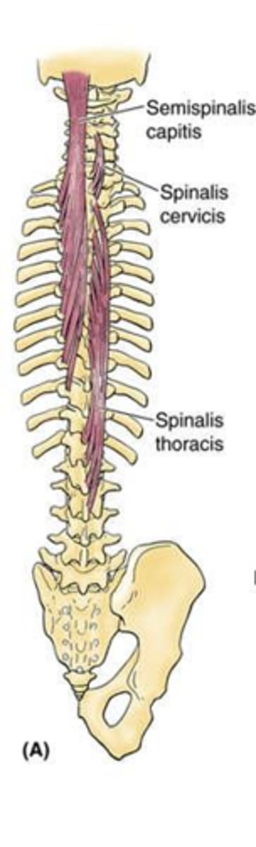 <p>Internal and external vertebral venous plexuses, which drain into intervertebral veins.</p>