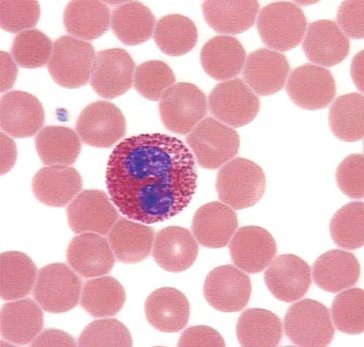 <p>what is the <strong>WBCs %</strong> for <strong>eosinophils</strong></p>