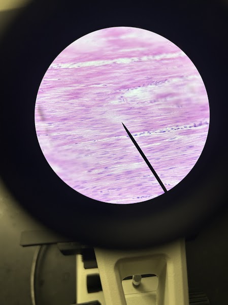 term image