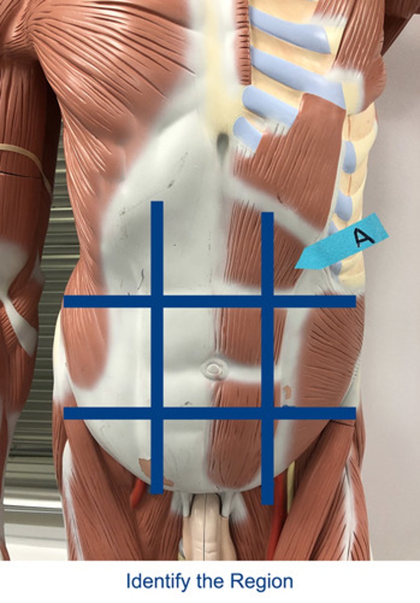 <p>Identify the area indicated by the arrow.</p>