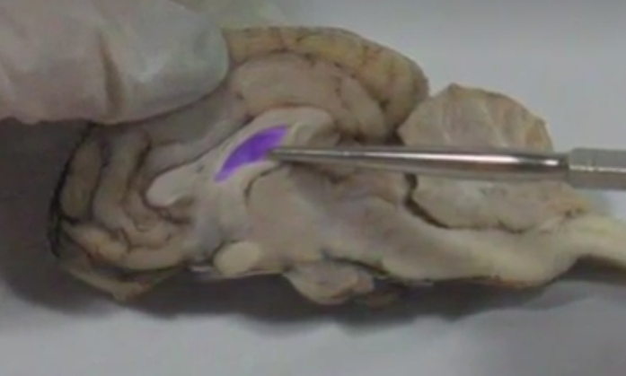 What part of the brain is this called?