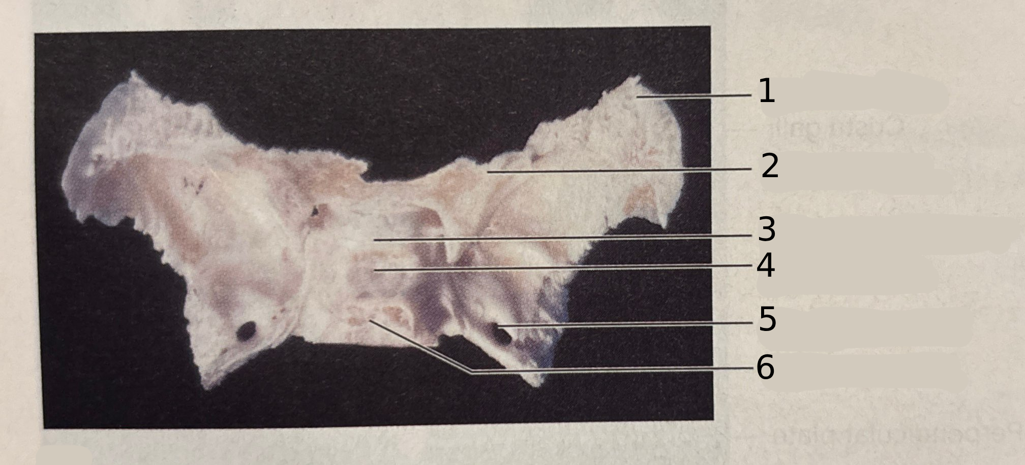 <p>What view of the bone is this?</p>