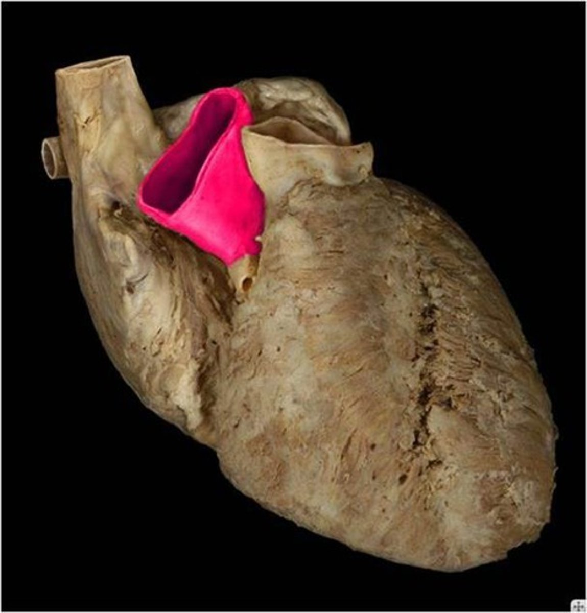 <p>Name this vessel and be specific to the part of the vessel that is highlighted.</p>