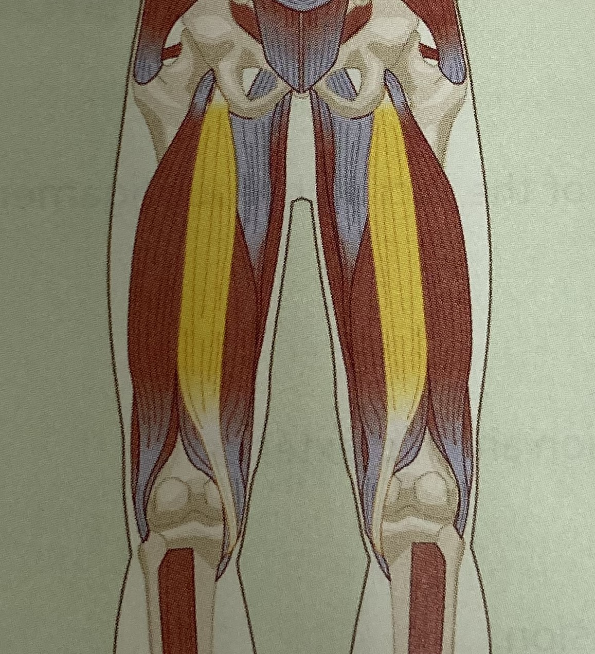 <p>category: hamstring complex</p><p>origin: bottom of the pelvis</p><p>insertion: posterior aspect of the tibia</p><p>isolated function: concentric knee flexion, hip extension, and tibial internal rotation</p><p>integrated function: eccentric knee extension, hip flexion, tibial external rotation</p><p>stabilizes the LPHC and knee</p>