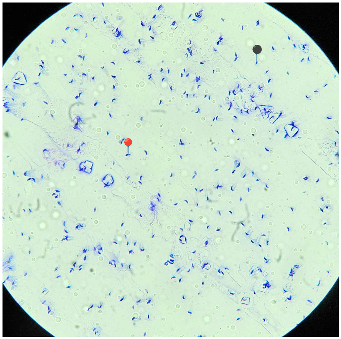 <p><strong><em>Toxoplasma gondii</em></strong></p><p>(Trofozoit)</p><p></p><p></p><p><strong>Parazytoza:</strong><em> Toksoplazmoza</em></p><p></p>