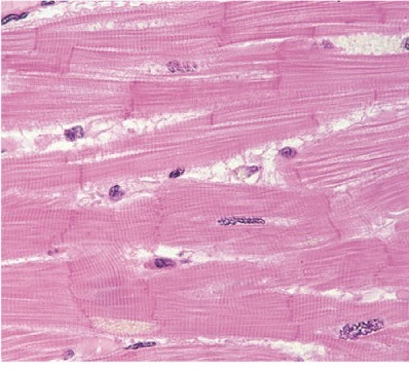 <p>cardiac</p>